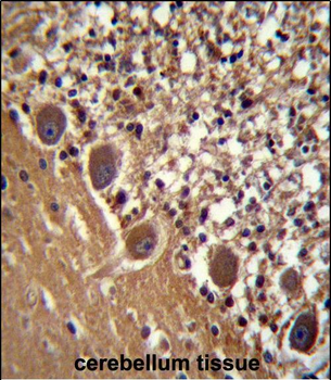 FARSB Antibody (C-term)