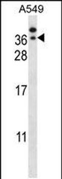 GTF2E2 Antibody (C-term)
