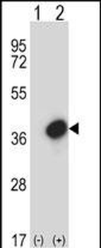 GTF2E2 Antibody (C-term)