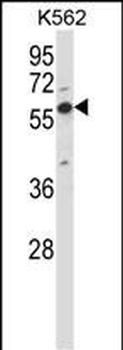 Mouse Oxsr1 Antibody (N-term)