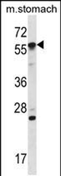 Mouse Oxsr1 Antibody (N-term)