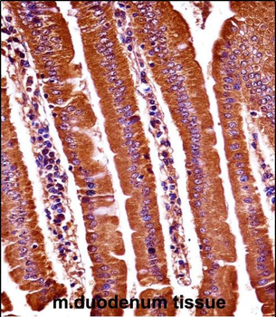 Mouse Oxsr1 Antibody (N-term)