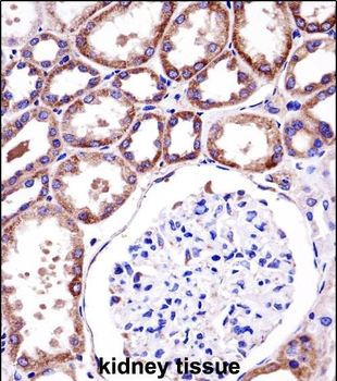RC3H1 Antibody (C-term)