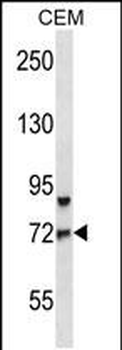 FOXO3 Antibody (Center)