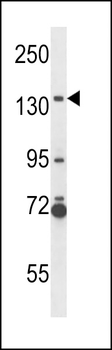 NOS2A Antibody (N-term)
