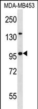 NUP88 Antibody (C-term)