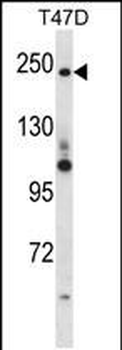 PPL Antibody (C-term)