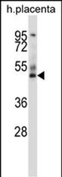 GRAMD3 Antibody (N-term )