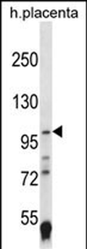 EPAS1 Antibody (C-term)