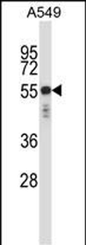 KRT6C Antibody (N-term)