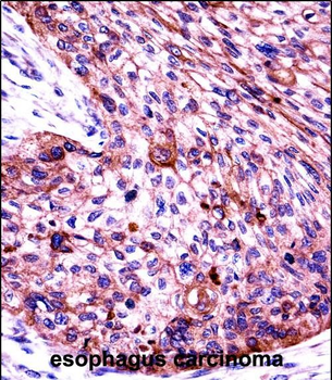 KRT6C Antibody (N-term)