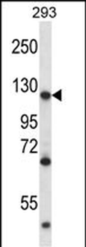 MATR3 Antibody (N-term)