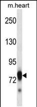 Mouse Scyl3 Antibody (C-term)