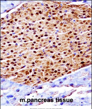 Mouse Scyl3 Antibody (C-term)