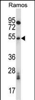 Mouse Phkg1 Antibody (C-term)