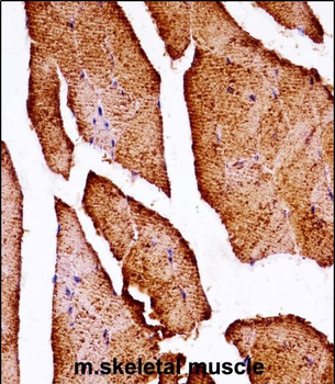 Mouse Map3k10 Antibody (N-term)