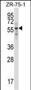 Mouse Rps6kb1 Antibody (C-term)