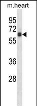 Mouse Rps6kb1 Antibody (C-term)