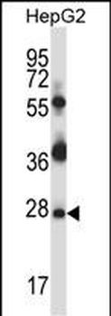 Mouse Tp53rk Antibody (Center)