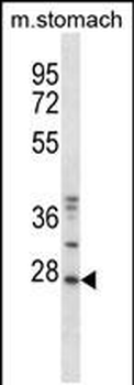 Mouse Tp53rk Antibody (Center)