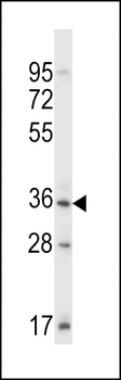 Mouse Sgk110 Antibody (C-term)