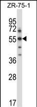 Mouse Sgk3 Antibody (C-term)