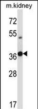 Mouse Tssk6 Antibody (C-term)