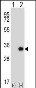 Mouse Tssk6 Antibody (C-term)