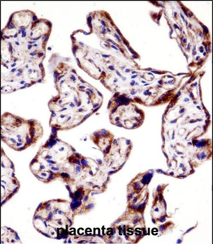 TEAD3 Antibody (N-term)