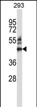 ZNF660 Antibody (C-term)