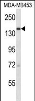 URB2 Antibody (C-term)