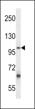 ZC3H12B Antibody (C-term)