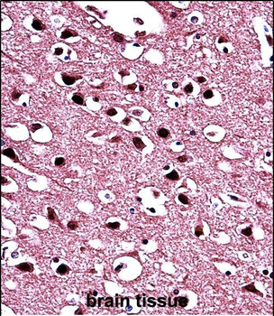 BIN1 Antibody (Center)