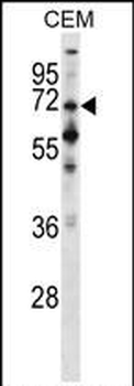 PPEF1 Antibody (Center)