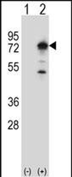 PPEF1 Antibody (Center)