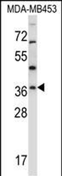 RNF144A Antibody (Center)