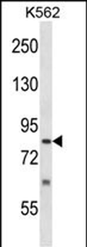 SENP5 Antibody (C-term)