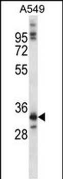 NKX6-1 Antibody (C-term)