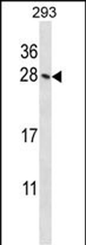 Mouse Hoxb4 Antibody (N-term)
