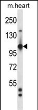 Mouse Tie1 Antibody (Center)