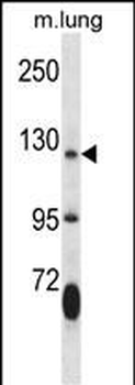 JAK2 Antibody (Center)