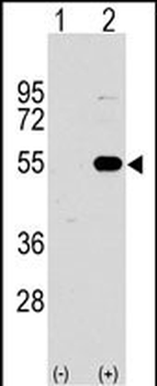 SPRED1 Antibody (N-term)