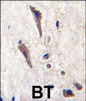 SPRED1 Antibody (N-term)