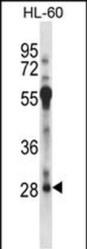 RFXAP Antibody (C-term)