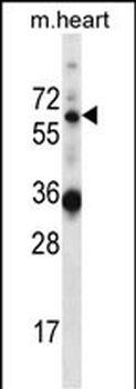 GATAD2B Antibody (N-term)