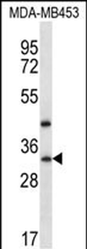 TAF9B Antibody (N-term)