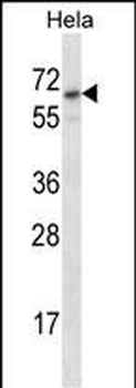 STS Antibody (C-term)
