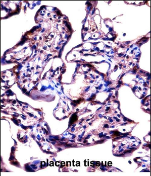 STS Antibody (C-term)
