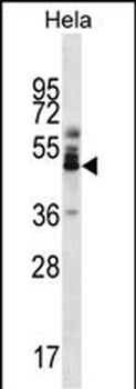 ZNF174 Antibody (Center)