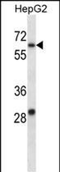 KCNC1 Antibody (C-term)